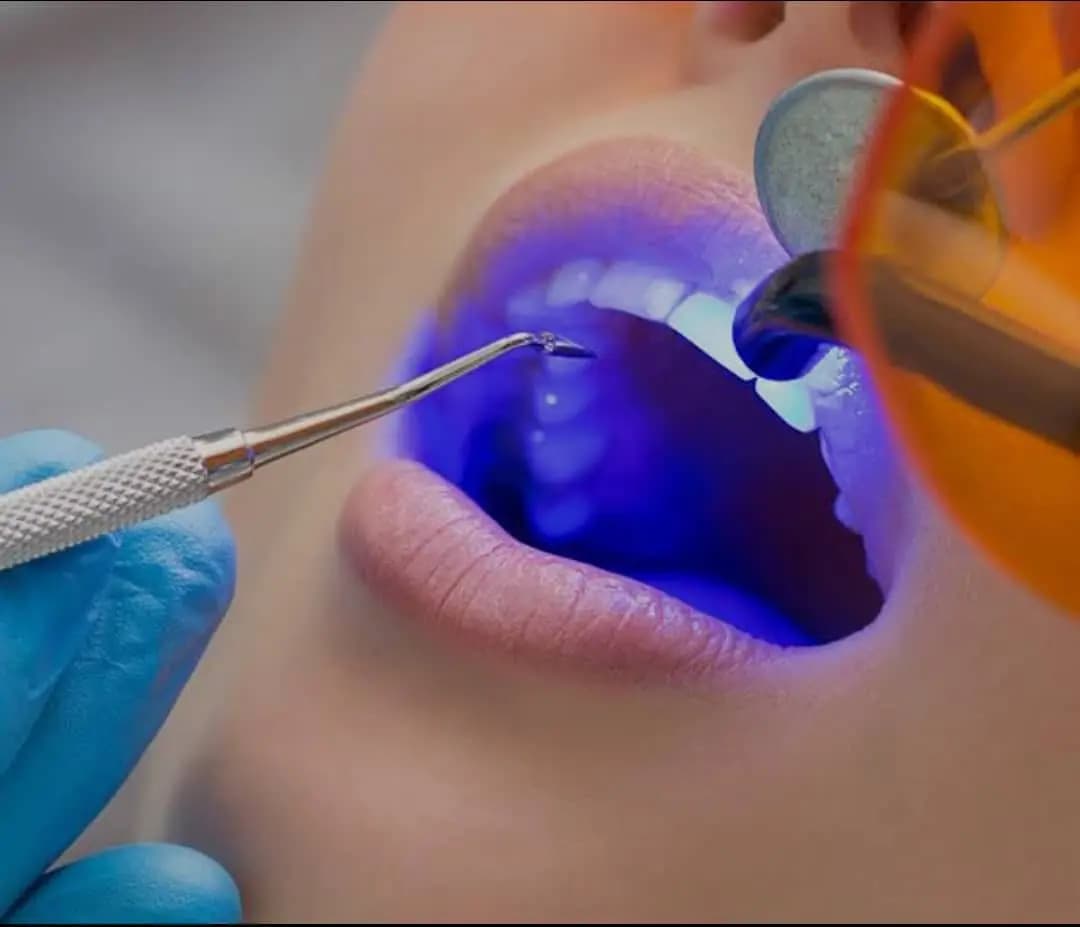 Traitement dentaire laser